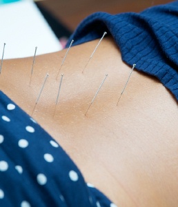 Acupuncture is a well known ancient weight loss and overall health aid.
